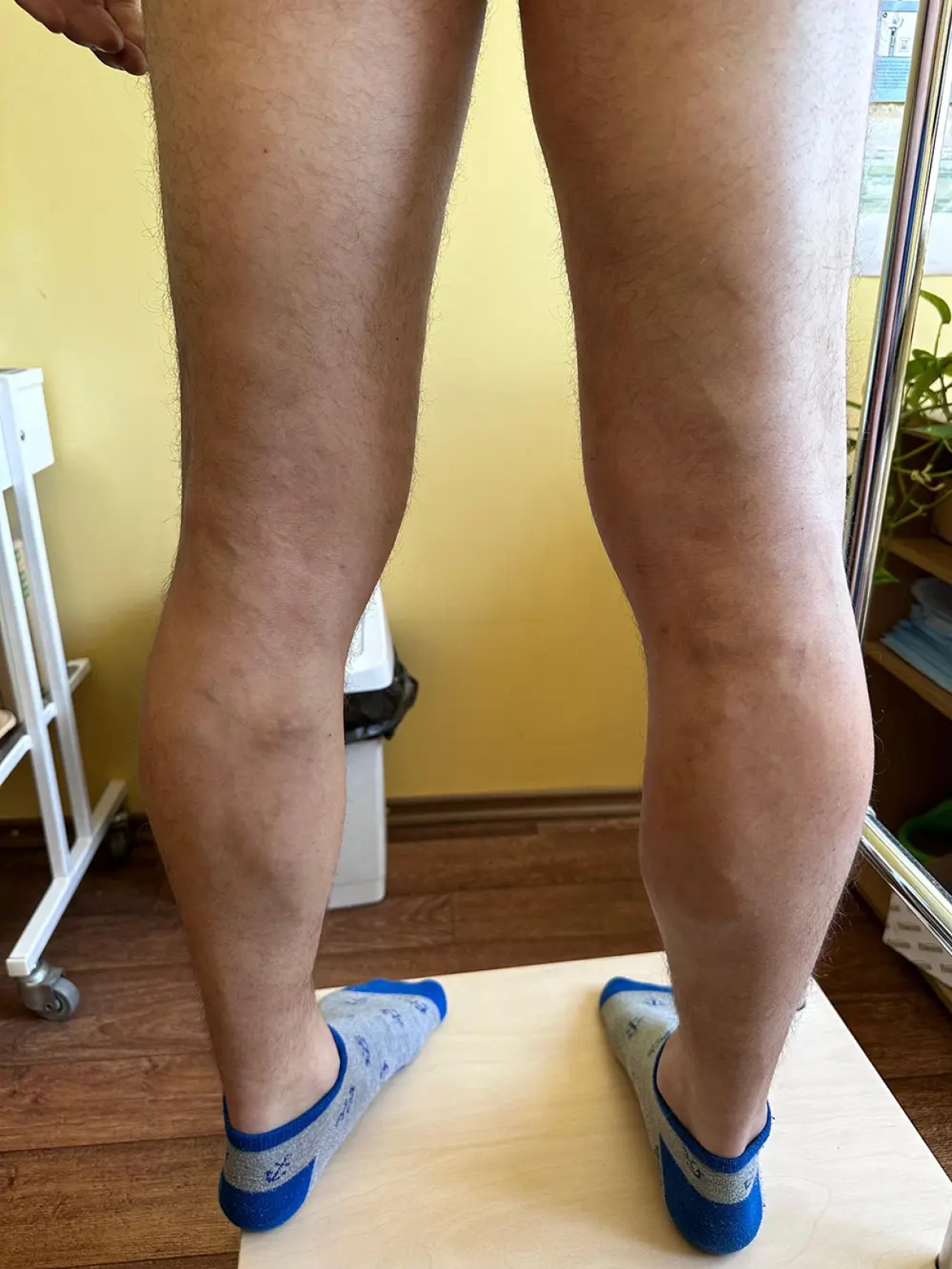 16 mēnešus pēc operācijas