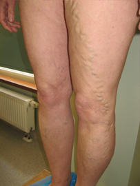 bc2327dc-fc74-4544-9cf7-803738c59b4a