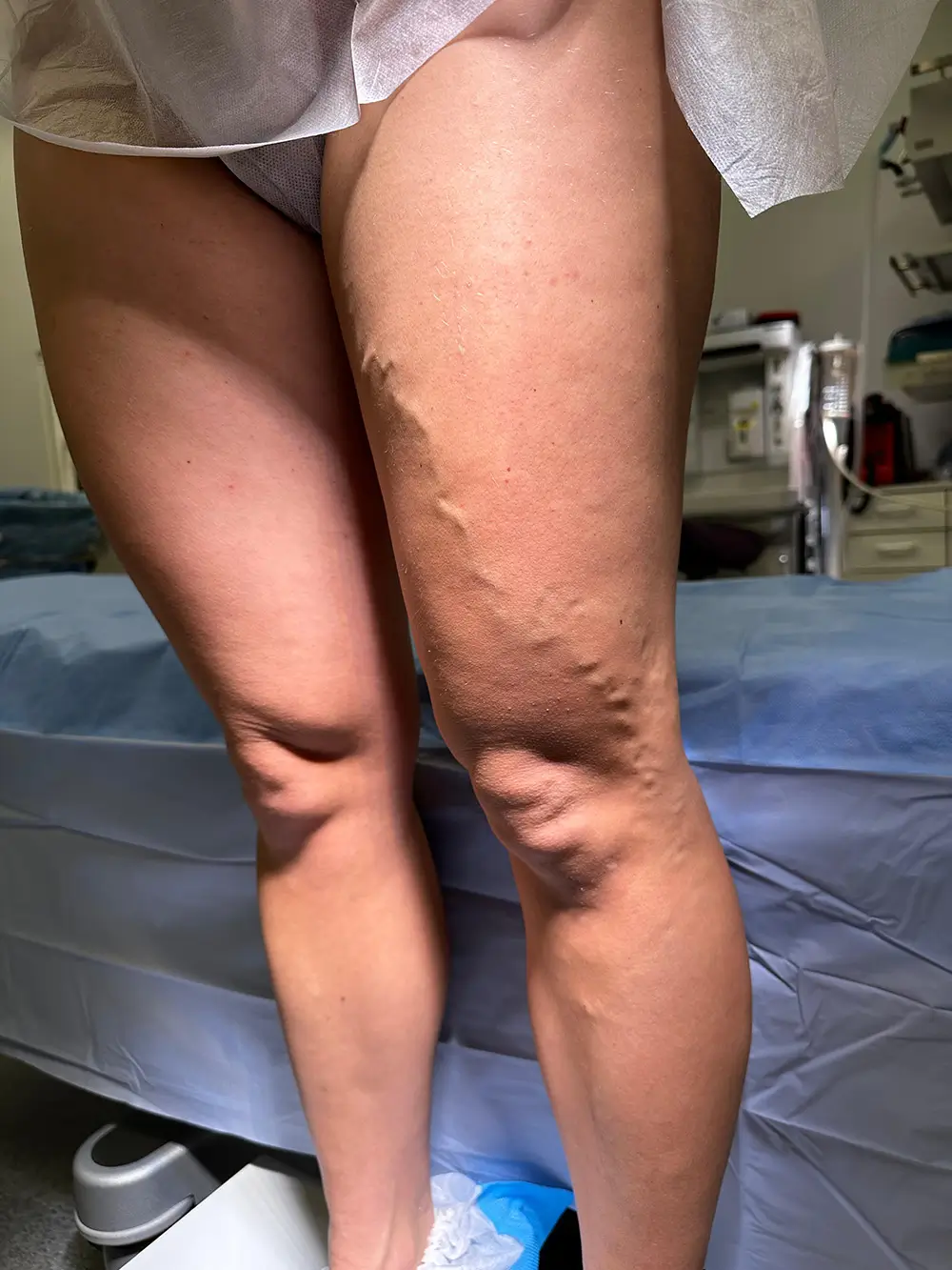 nr.1.Dr_.Ints-Udris-Total-EVLA-metode-pirms