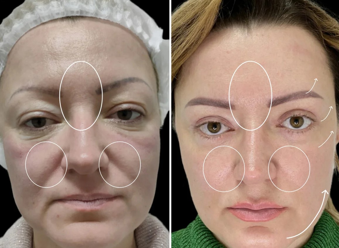 Zemits Facial_Technologies_