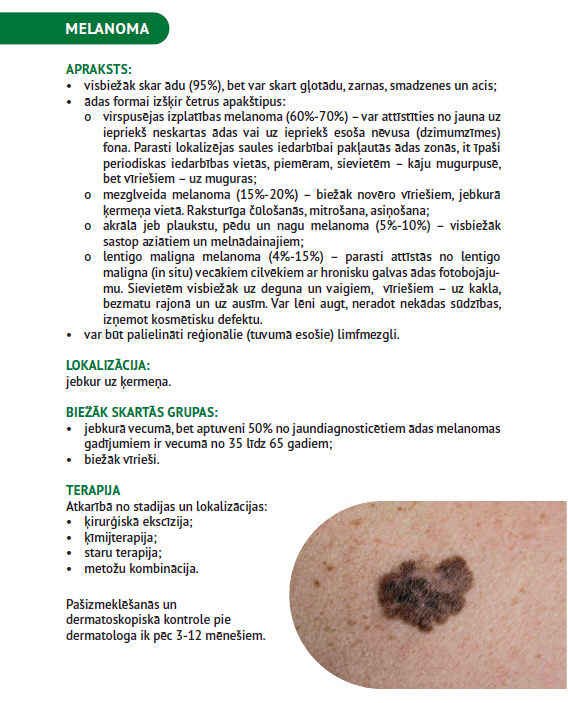 melanoma