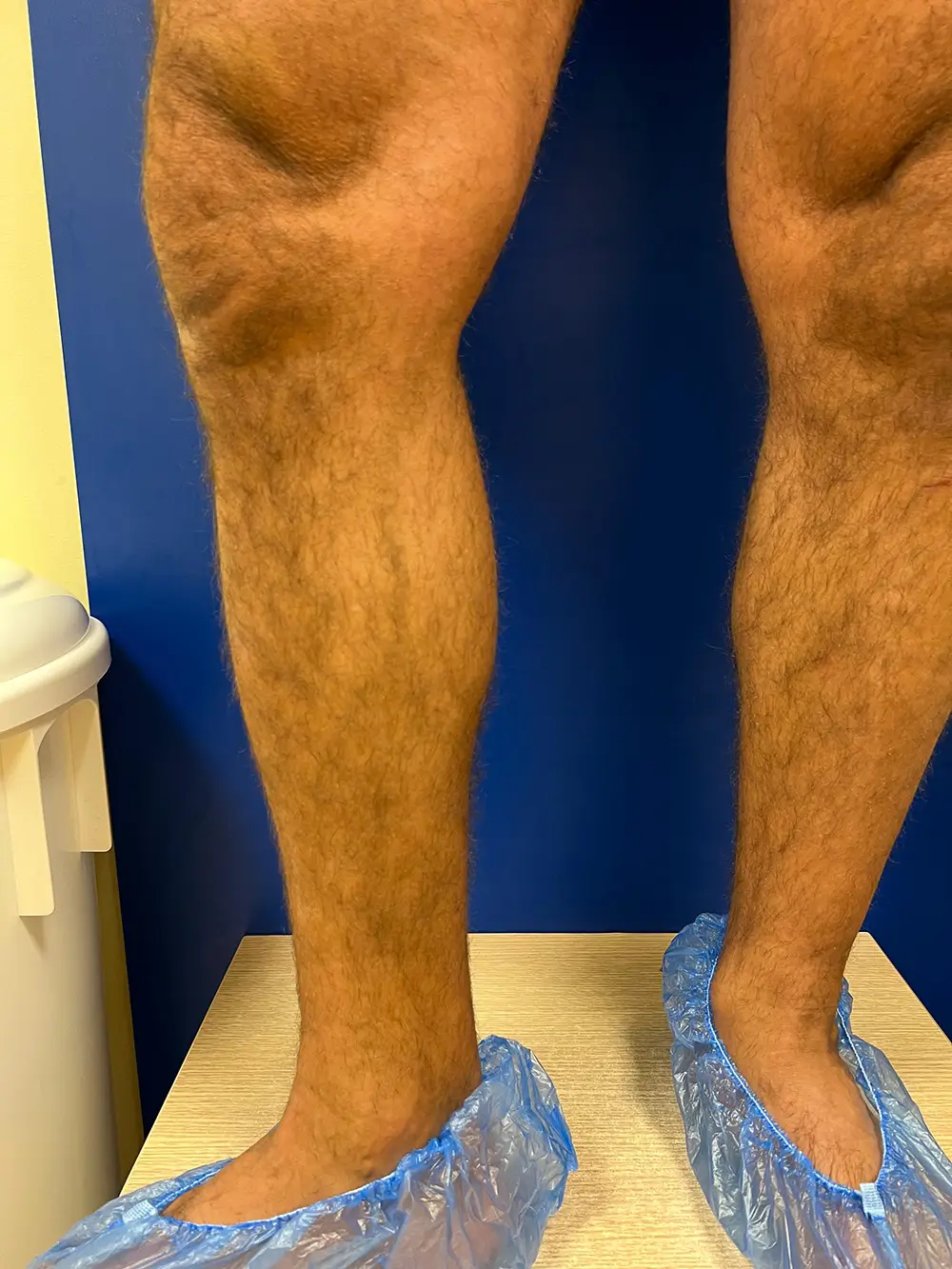 nr.2.-Dr.-Ints-Udris-Total-EVLA-metode-17-menesus-pec-operacijas