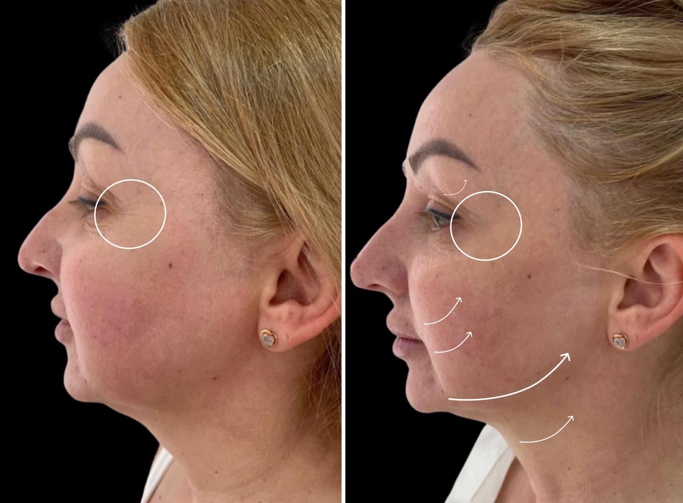 Zemits_2Facial_Technologies_.jpg