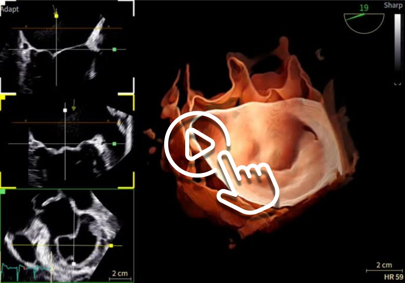 Vivid™ Pioneer “GE HealthCare” play