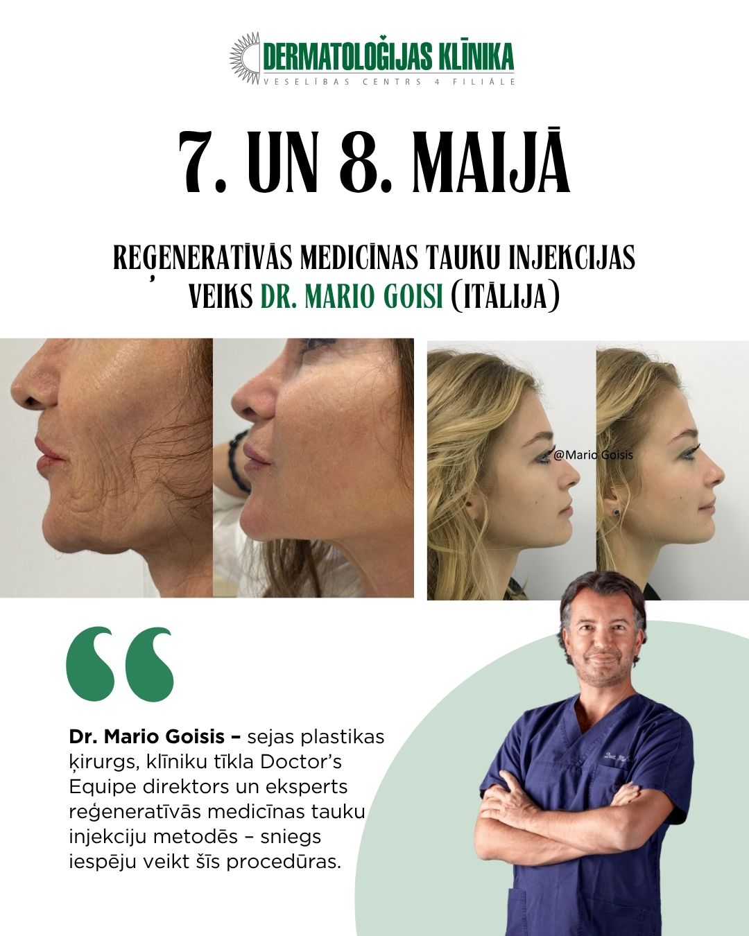 Dr. Mario Goisis veic mūsdienīgas estētiskās un reģeneratīvās medicīnas procedūras.