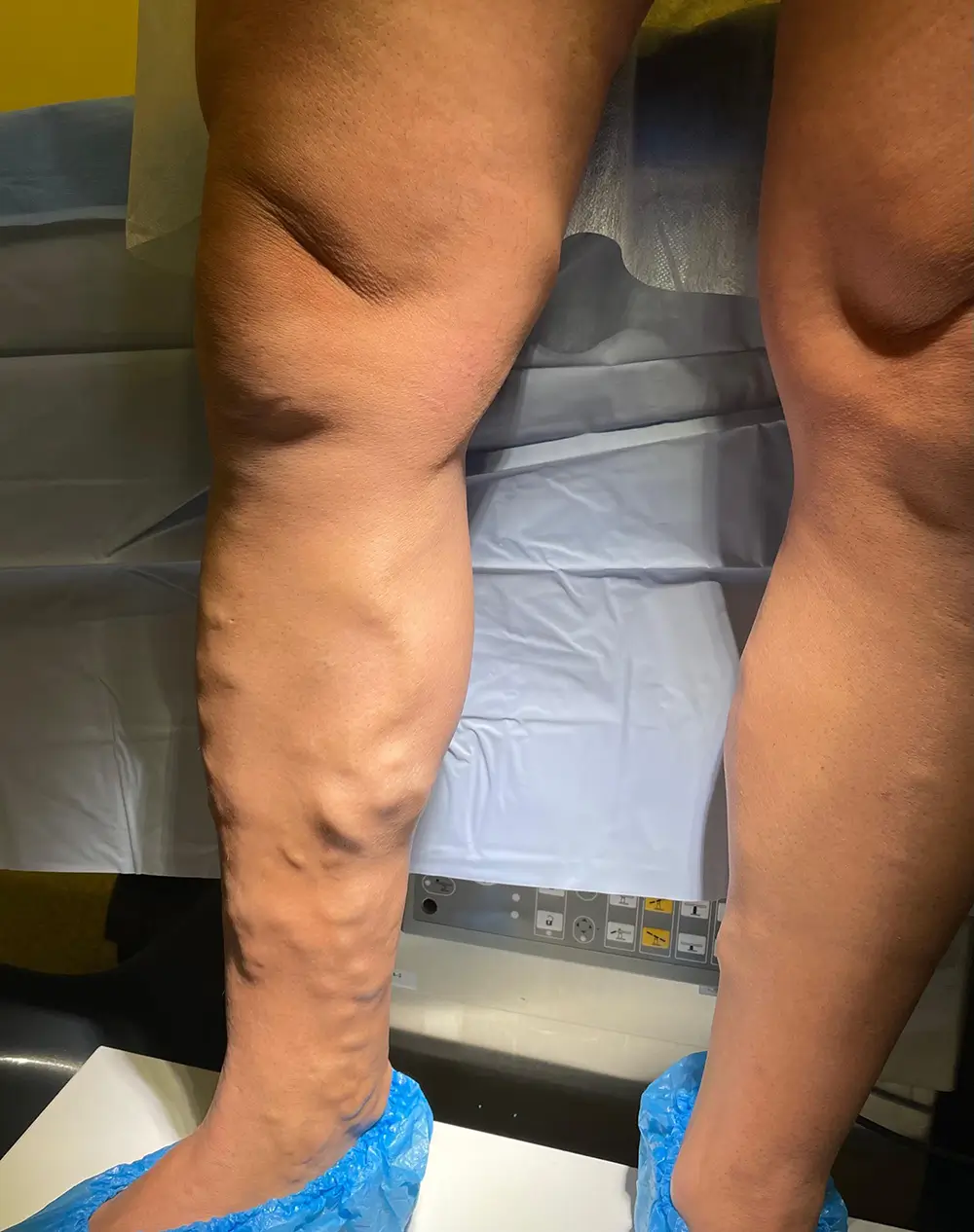 nr.2.-Dr.Ints-Udris-Total-EVLA-pirms