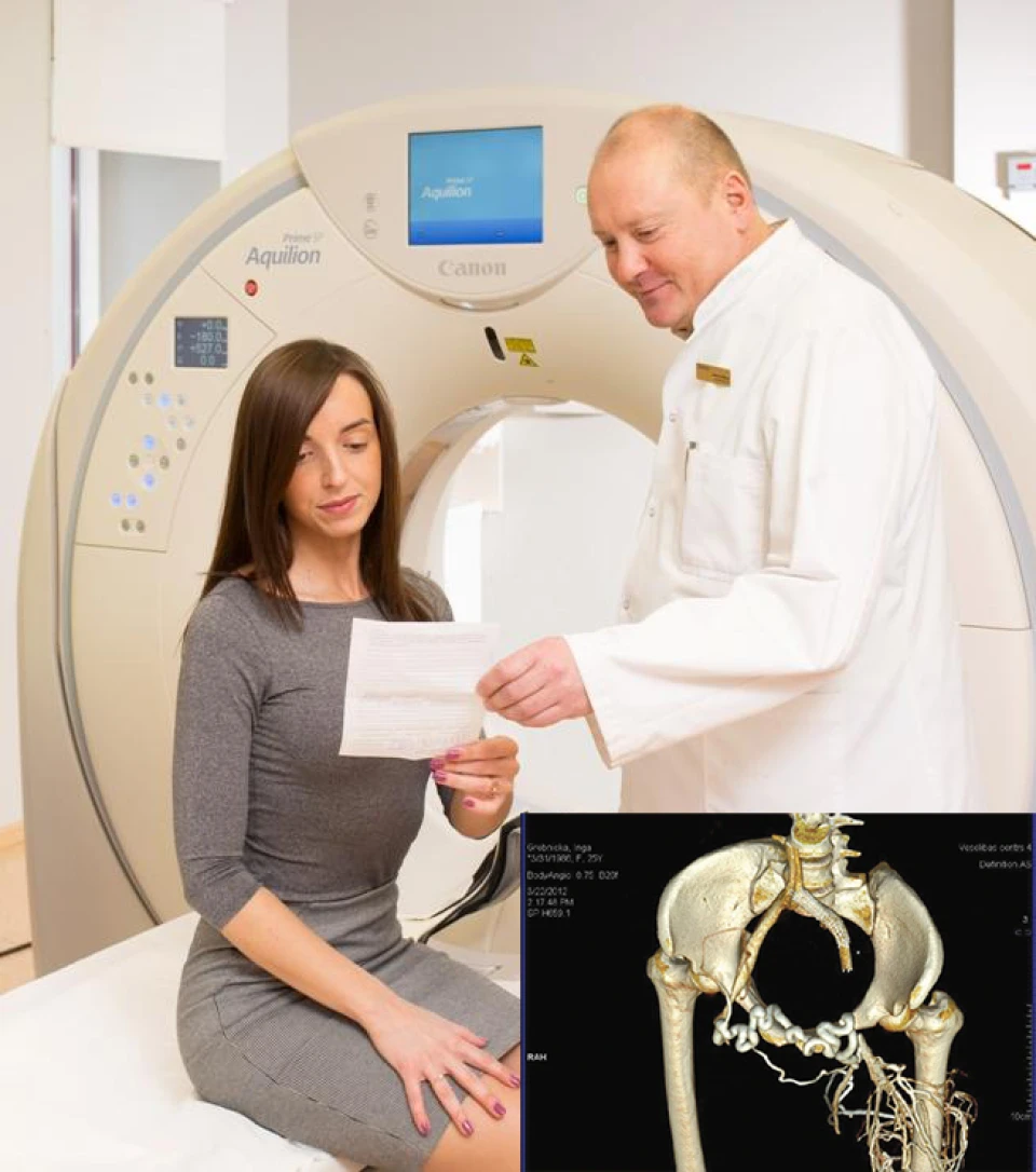 Datortomogrāfiskā flebogrāfija 