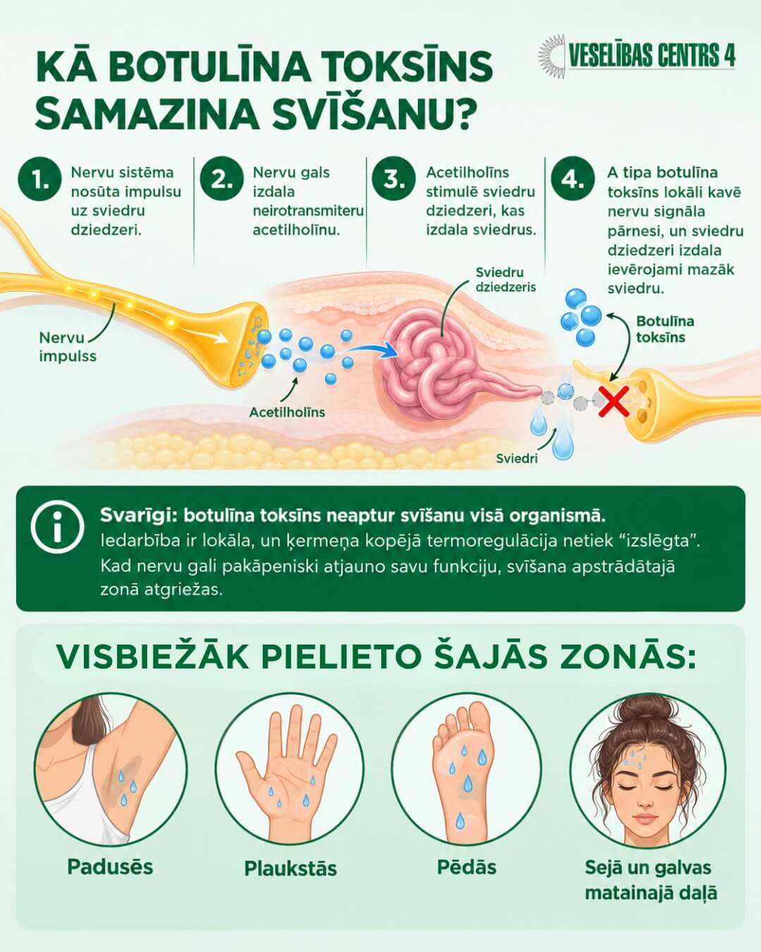 Kā botulīna toksīns samazina svīšanu Kā botulīna toksīns samazina svīšanu
