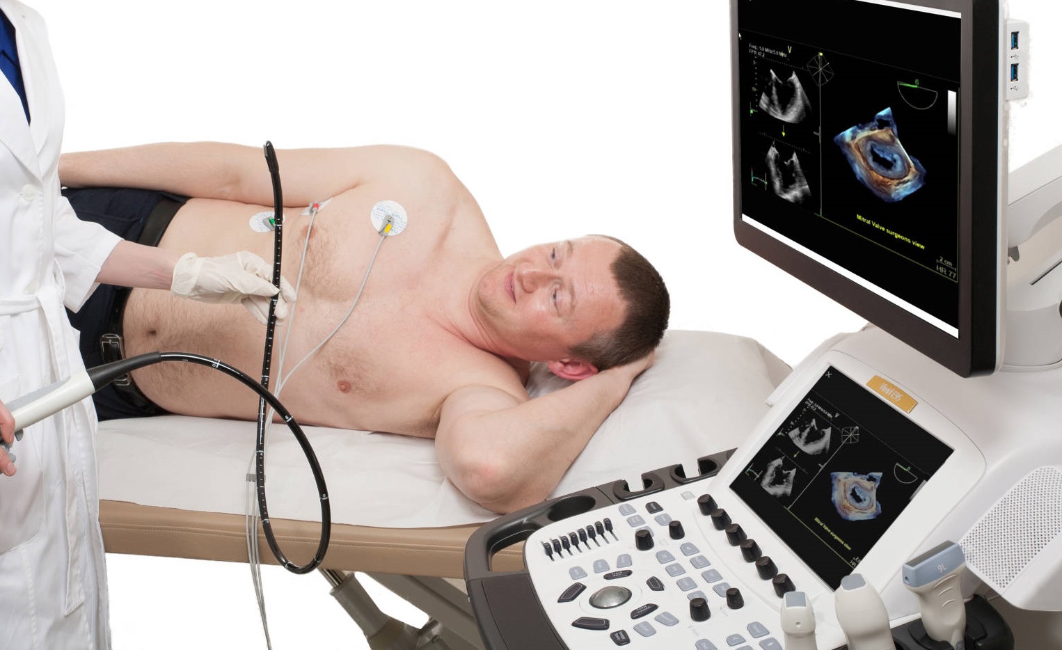 Transezofageālā ehokardiogrāfija (TEE)