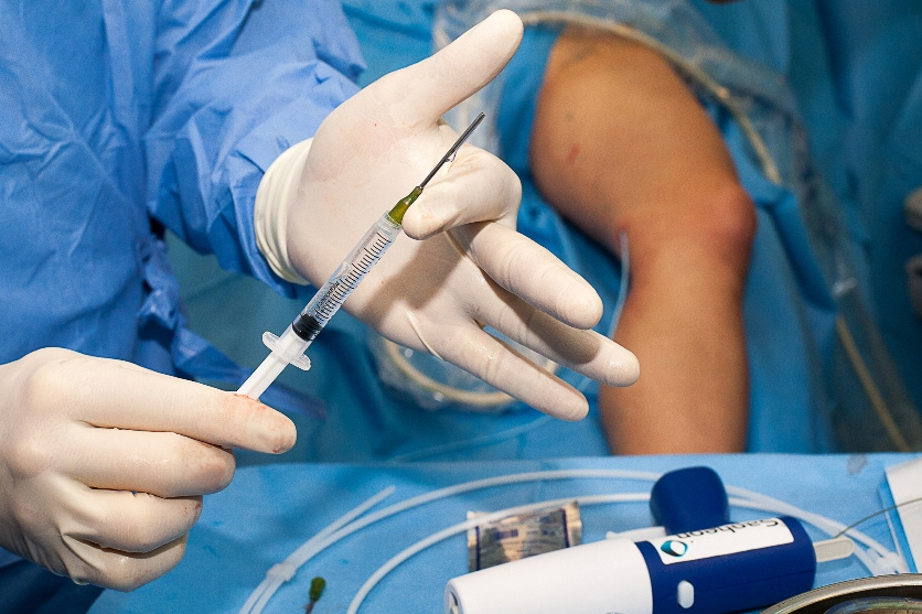 Minimāli invazīva vēnu ārstēšana ar skleroterapiju Veselības centrā 4